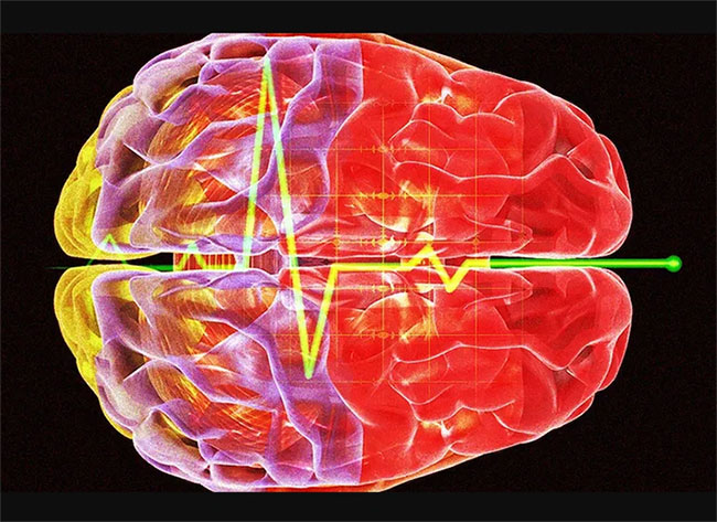 Có sự gia tăng các sóng não được gọi là dao động gamma trong quá trình thu hồi trí nhớ.